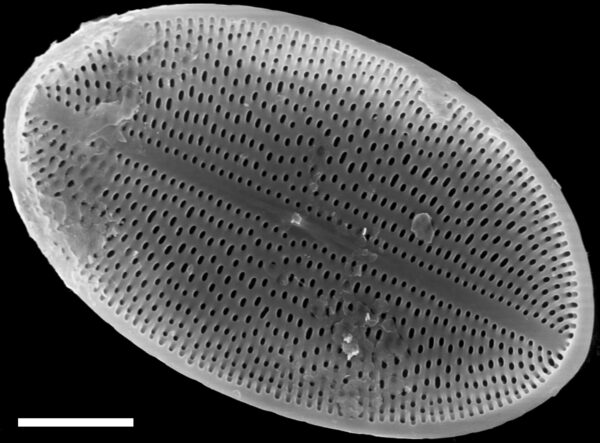 Cocconeis placentula SEM2