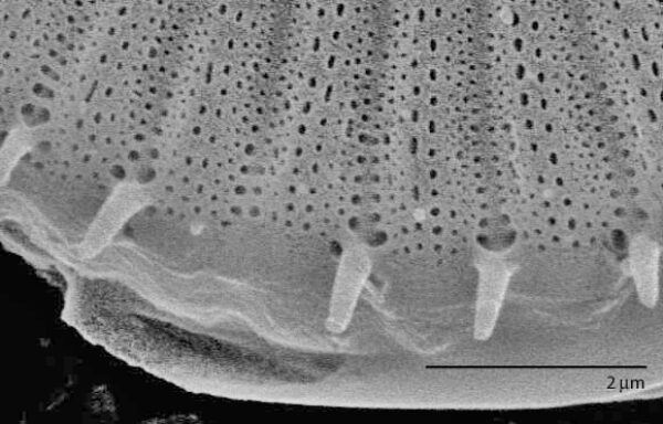 Cyclotella meneghiniana SEM1