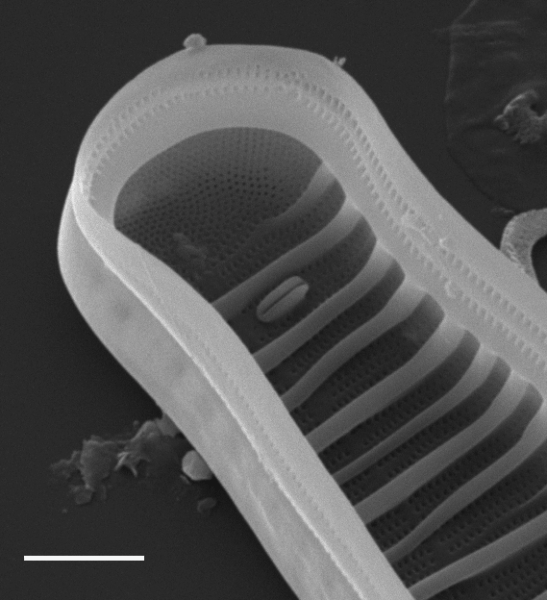 Diatoma ehrenbergii SEM2