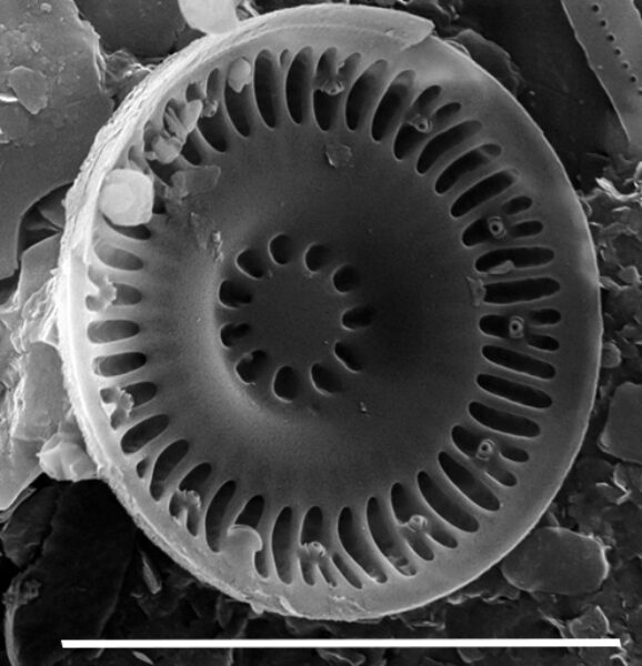 Discostella asterocostata SEM4 copy