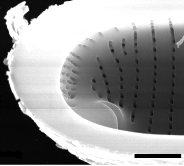 Eunotia areniverma SEM1