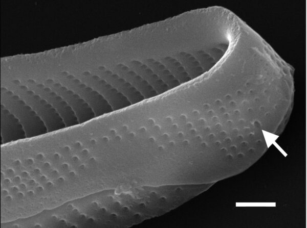 Eunotia macroglossa SEM3