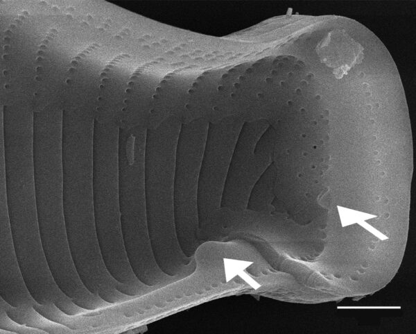 Eunotia montuosa SEM1