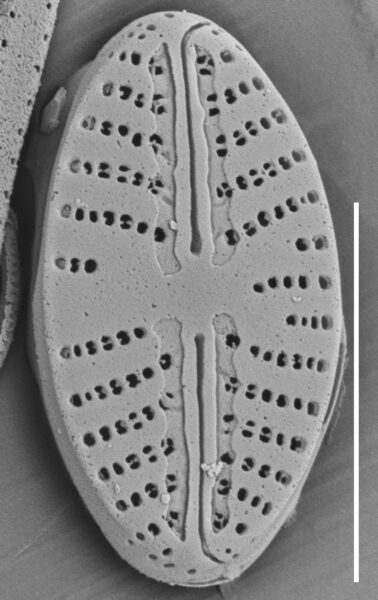 Eolimna aboensis SEM1