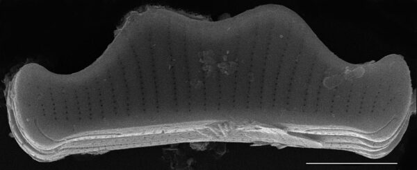 Eunotia subherkiniensis SEM1