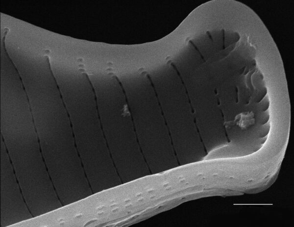 Eunotia subherkiniensis SEM2