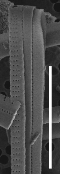 Fragilaria synegrotesca SEM1