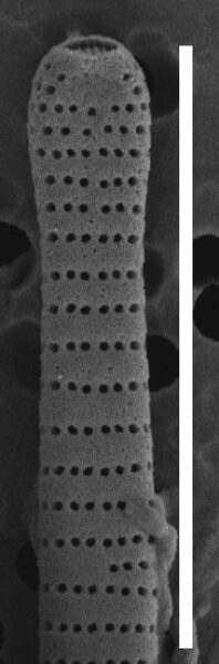 Fragilaria synegrotesca SEM3