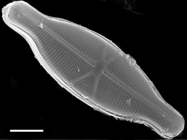 Capartogramma crucicula SEM2