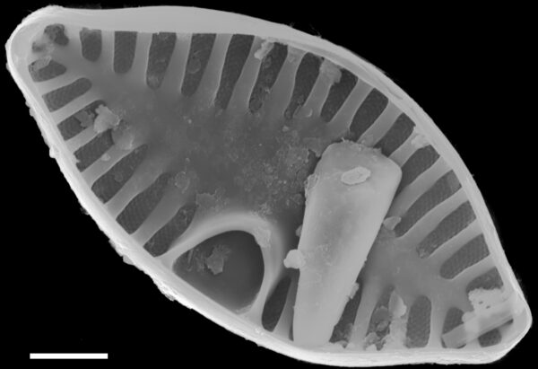 Planothidium abbreviatum SEM2