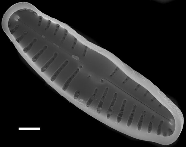 Reimeria uniseriata SEM3