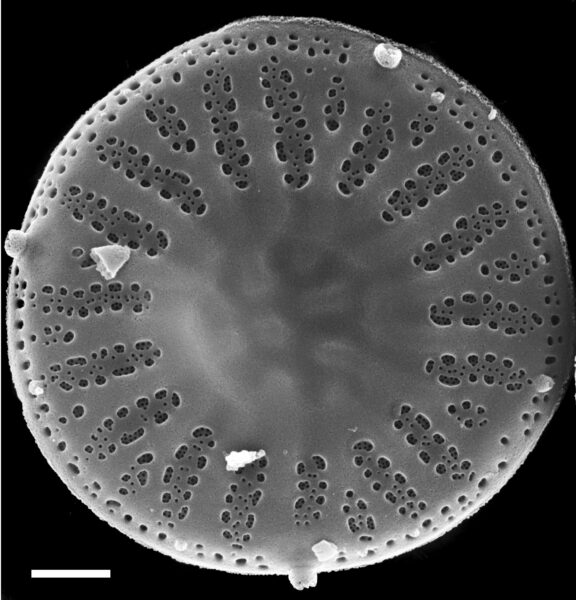 Discostella lakuskarluki SEM1