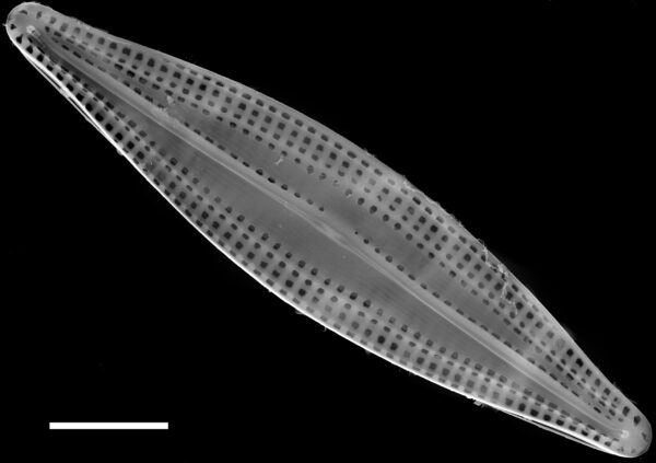 Biremis circumtexta SEM1