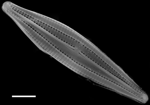 Biremis circumtexta SEM2