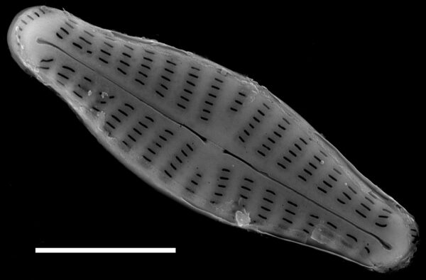 Hippodonta coxiae SEM1