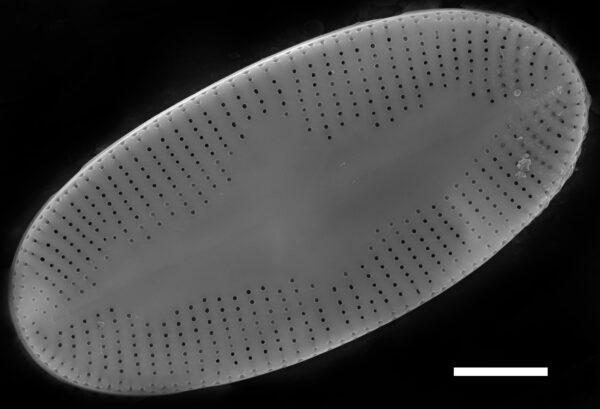 Psammothidium daonense SEM1