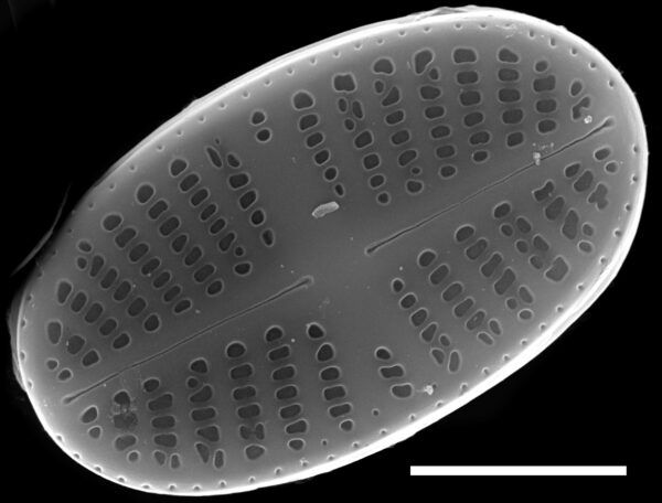 Psammothidium curtissimum SEM2