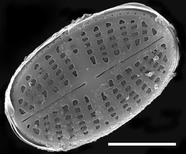 Psammothidium curtissimum SEM3