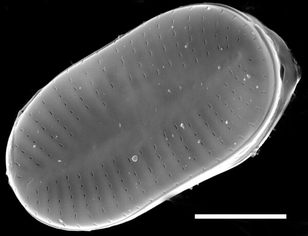 Psammothidium didymum SEM2