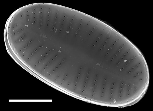 Psammothidium curtissimum SEM4