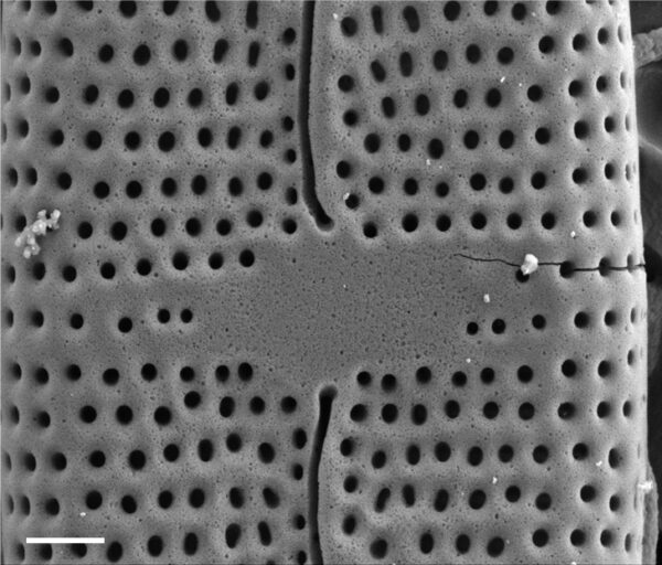 Mastogloia calcarea SEM1