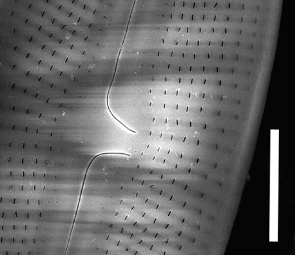 Muelleria spauldingiae SEM1