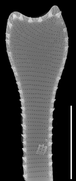 Actinella punctata SEM1