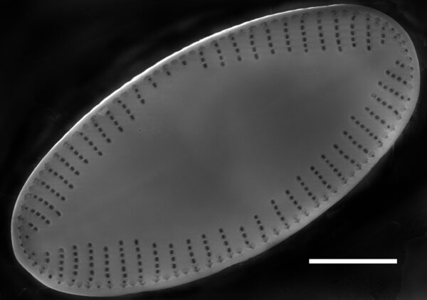 Psammothidium acidoclinatum SEM1