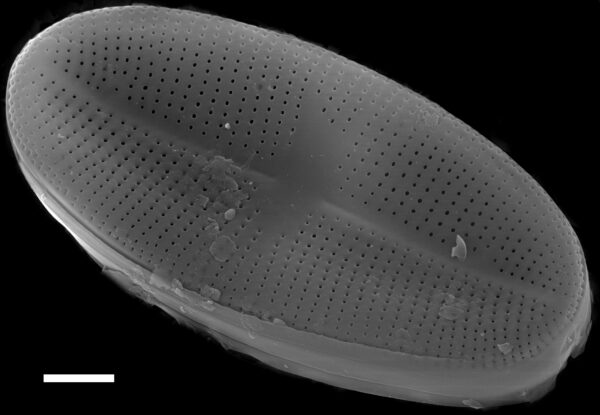 Psammothidium bioretii SEM1