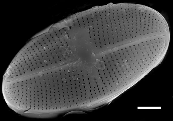 Psammothidium bioretii SEM4