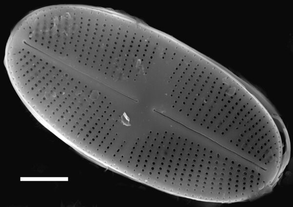 Psammothidium daonense SEM3