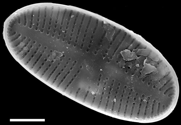 Psammothidium pennsylvanicum SEM1