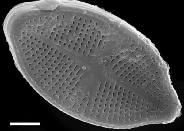 Psammothidium harveyi SEM3