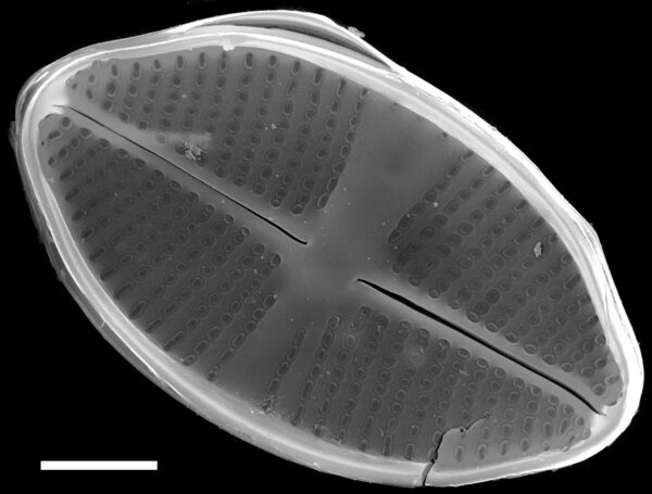 Psammothidium harveyi SEM4