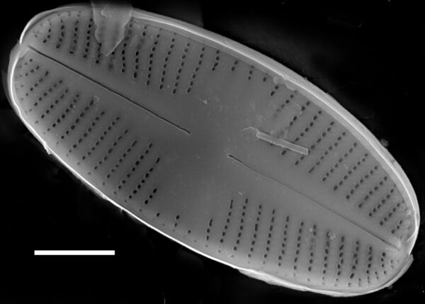 Psammothidium acidoclinatum SEM2