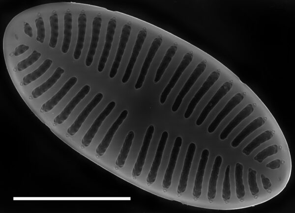 Platessa stewartii SEM1