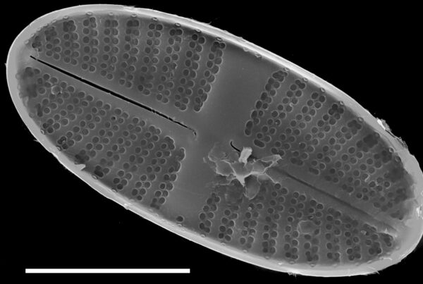 Platessa stewartii SEM2