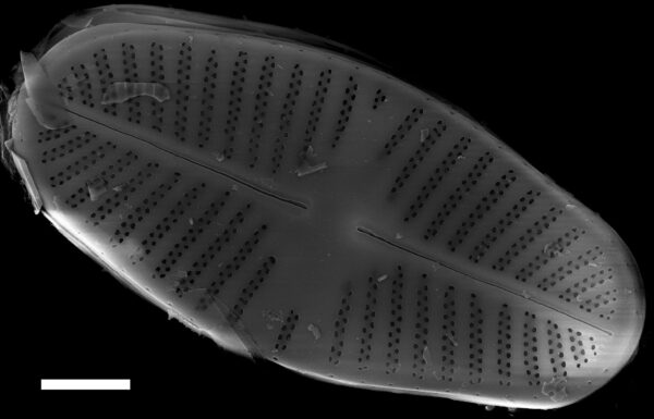 Platessa strelnikovae SEM1