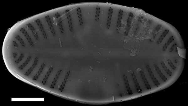 Platessa strelnikovae SEM2