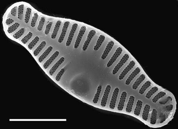 Planothidium haynaldii SEM1