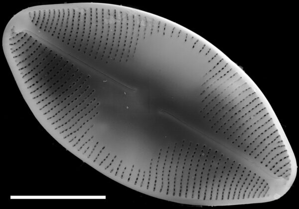 Eucocconeis americana SEM1