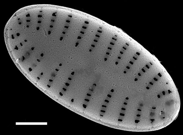 Karayevia oblongella SEM1