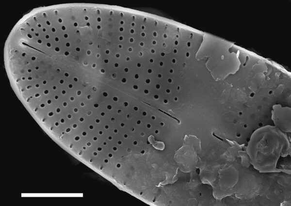 Karayevia oblongella SEM3