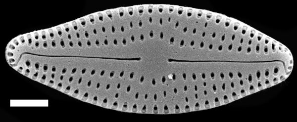 Nupela neglecta SEM3