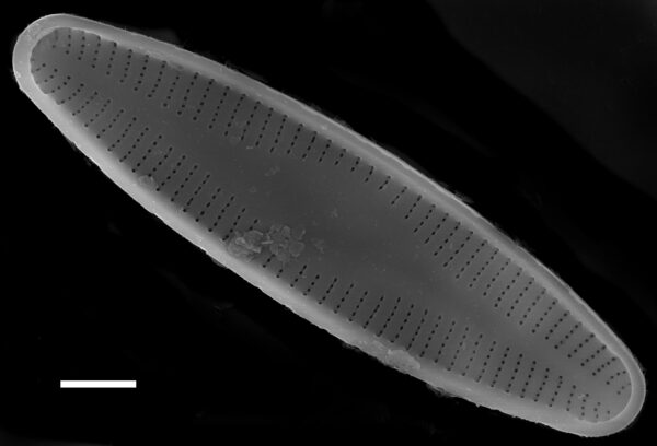 Nupela subrostrata SEM1