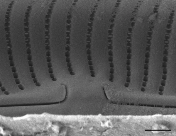 Encyonema norvegicum SEM2