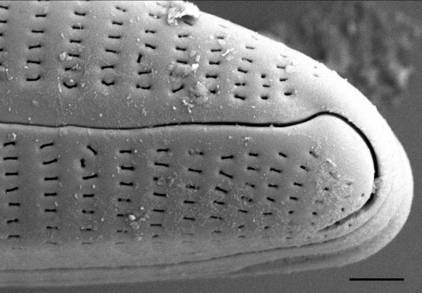 Encyonema norvegicum SEM3