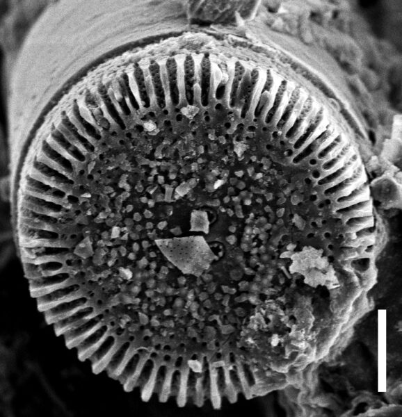 Orthoseira oregoniana SEM 1 COLO 12348