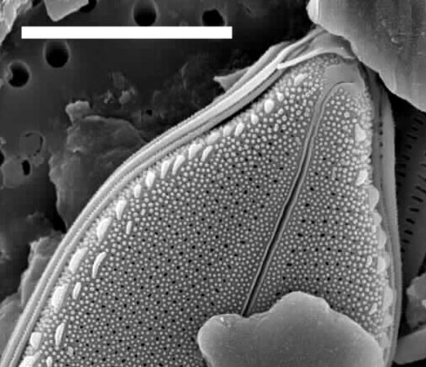 Playaensis circumfimbria SEM2