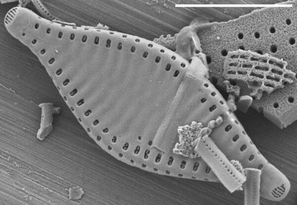 Pseudostaurosira parasitica SEM1